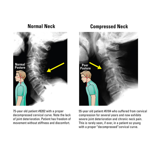 At Home Neck and Back Pain Reliever