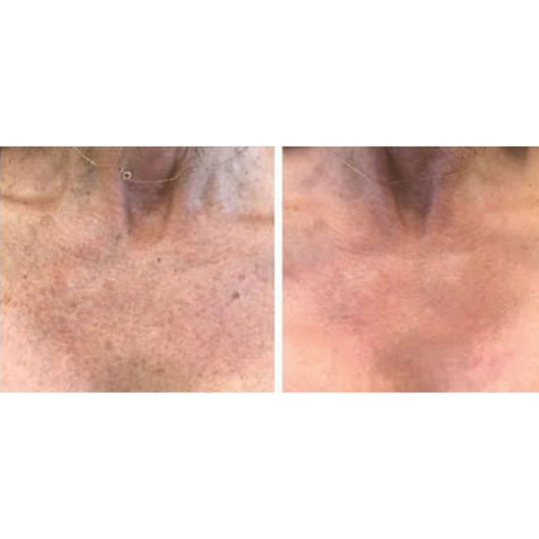 iqXKhmbuIUbA1T2ZNg1U0