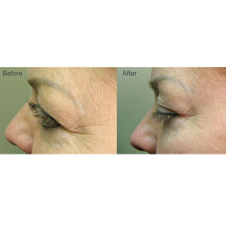 5MykMhDe613YG7QXtalRva