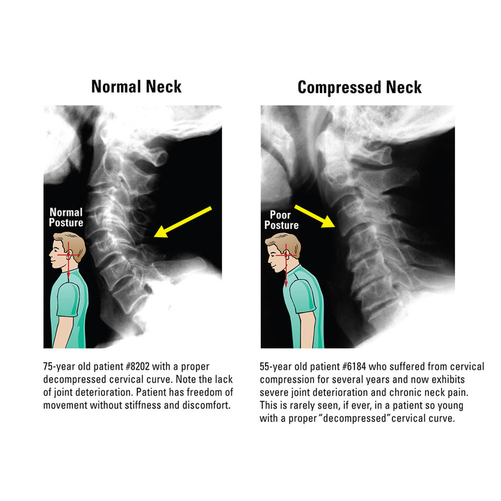 At Home Neck and Back Pain Reliever
