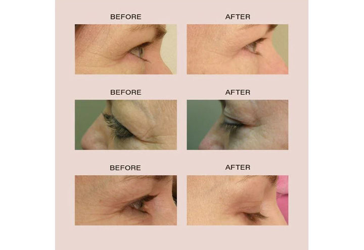 5G1LxcE1NaC6HfWfXGI4Zl