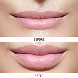 TWOBIYURSSPXSkKv2mMVm