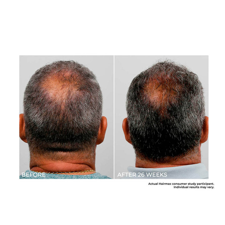 2AQeFt5VQ9Q4s25RlbAd5p