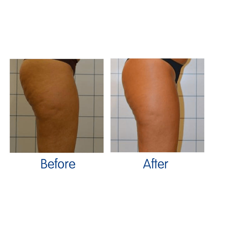 4N3yPcuZoS9GaQGCV76td6