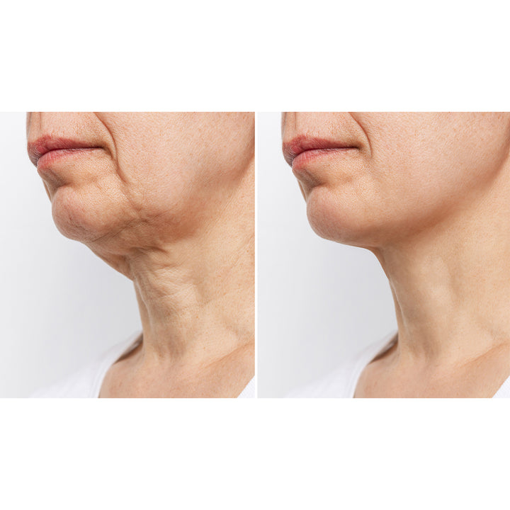 3IpLxPfoFM89JKzOMw45uf