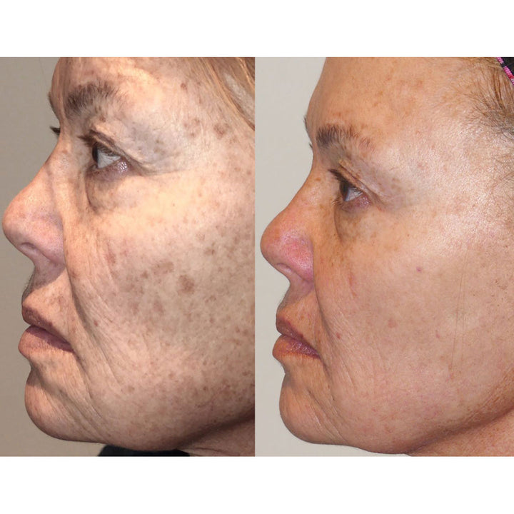 37P73VC26BLgI7FkAF7ekc