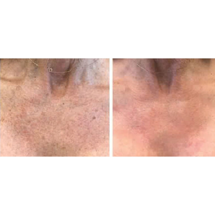 iqXKhmbuIUbA1T2ZNg1U0