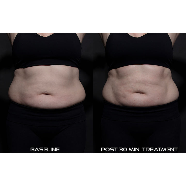 3XMPZf6ozWmnF598wwxJ8J