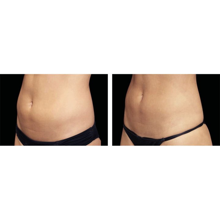 7BuFCXomtHz39VHHSAkiza